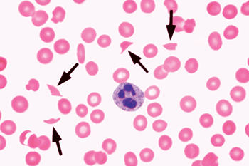 color atlas of hematology glassy pdf to word